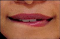 Menggigit Bibir - Lip Biting 2